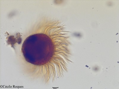 protozoo/Pelagostrobilidium neptuni (1)(copy)_thumb.jpg